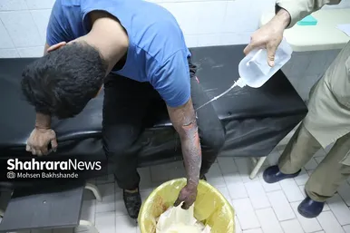بخش سوختگی بیمارستان امام رضا(ع) در شب چهارشنبه سوری