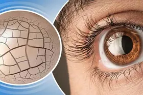 ۵ دارویی که مصرف آن&zwnj;ها، سبب خشکی چشم می&zwnj;شود