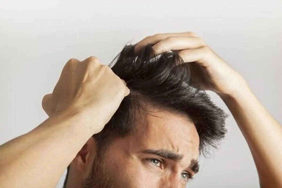 دلایل شایع خارش پیشانی چیست؟