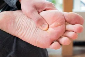 چرا پا میخچه می&zwnj;زند؟ | تفاوت میخچه با زگیل کف پا چیست؟