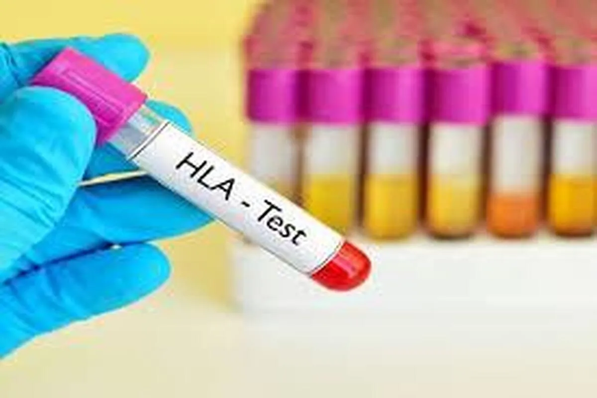 افزایش بانک اطلاعاتی HLA در کشور ضروری است