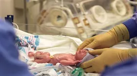 چرا زایمان زودرس اتفاق می&zwnj;افتد؟