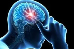 از هر ۴ زن یک نفر به میگرن مبتلا است
