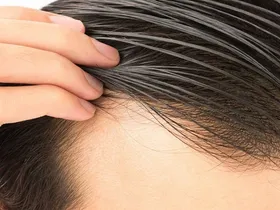 راهکار&zwnj;های از بین بردن چربی موی سر