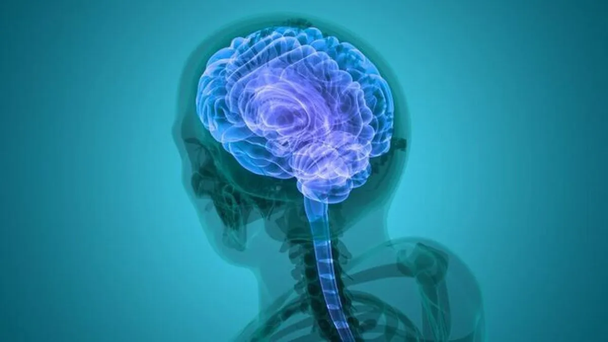 شناسایی پنج زیرگروه آلزایمر در جهان