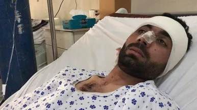 عکس‌هایی از حمله دیروز به خبرگزاری صدای افغان در شهر مزار شریف