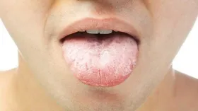 علل بوی بد دهان چیست و چگونه از بین می&zwnj;رود؟