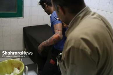 بخش سوختگی بیمارستان امام رضا(ع) در شب چهارشنبه سوری