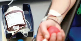 چرا با انجام حجامت نمی&zwnj;توان خون اهدا کرد؟+ آداب حجامت