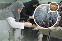 آمار دانش‌آموزانی که مبتلا به شپش سر شده‌اند، محرمانه است | کمبود مربی بهداشت