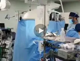 انتشار ویدیویی از عمل جراحی بابک جهانبخش در اینستاگرام