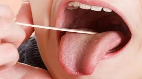 چرا دچار خشکی دهان می&zwnj;شویم؟