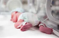 پارگی کیسه آب پیش از هفته ۳۷؛ علت مهم افزایش خطر زایمان زودرس