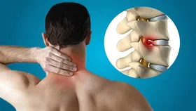 اینفوگرافی| برای درمان آرتروز گردن چه کنیم؟