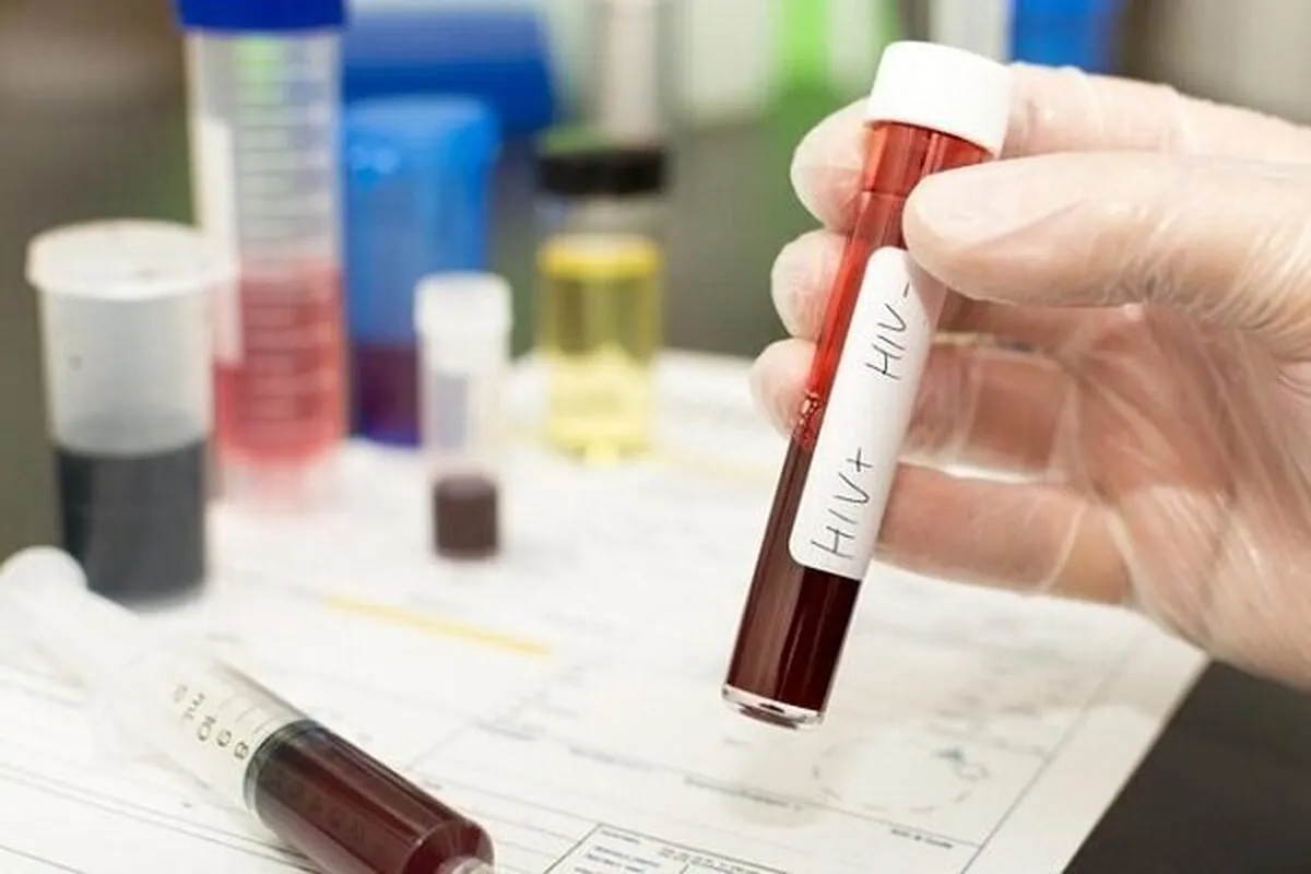 شناسایی ۴۱ هزار مبتلا به HIV در کشور تا کنون (۲۴ آبان ۱۴۰۴)