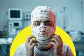 زیبایی قسطی | پرداخت قسط جراحی بینی به جای تأمین مایحتاج ضروری!