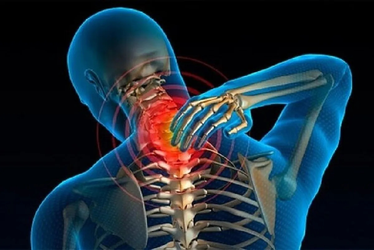 علائم هشدار‌های اولیه آرتروز گردن کدام اند؟ | روش های نوین درمان آرتروز گردن