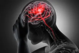 سکته مغزی، دومین علت مرگ در ایرانی&zwnj;ها