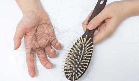 ریزش مو