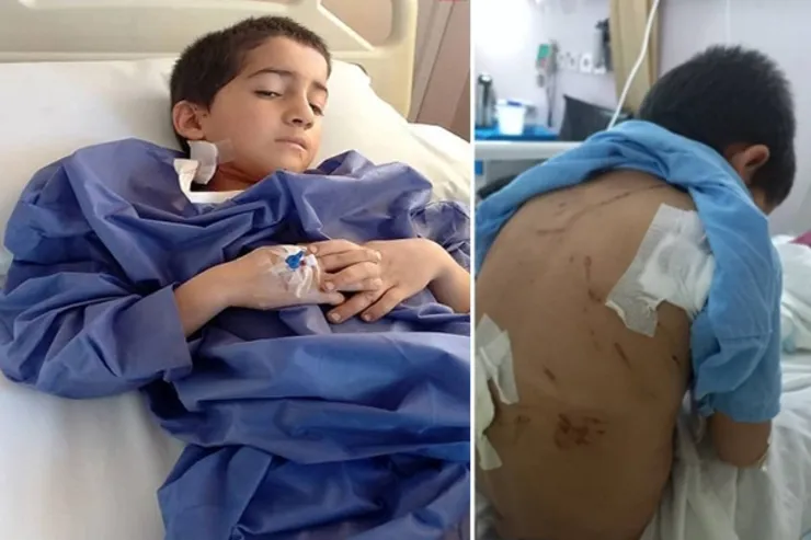 ۸ سگ وحشی به پسر بچه نیشابوری حمله کردند | حال پسربچه مساعد نیست