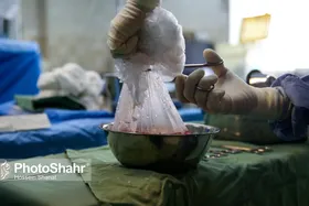 انجام ۱۶۸۸&zwnj; پیوند کلیه در مشهد