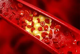 قرص چربی خون را چه زمان و چطور مصرف کنیم؟