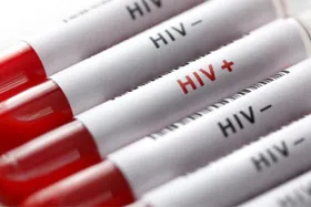 روابط جنسی خارج از عرف عامل اصلی ابتلا به HIV مثبت در کشورمان است | خطر رابطه&shy;&zwnj;های بی&shy;&zwnj;ضابطه!