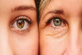 با این ماسک فوق&zwnj;العاده  تنها در سه روز چین و چروک پوست خود را رفع کنید