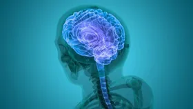 شناسایی پنج زیرگروه آلزایمر در جهان