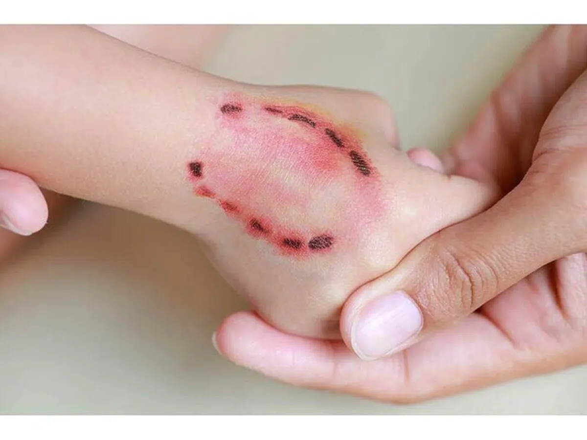 امدادرسانی اورژانس پیش بیمارستانی به ۲۵۰ مصدوم ناشی از حیوان گزیدگی
