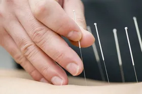 طب سوزنی چه تأثیری در بهبود دیابت دارد؟