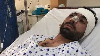 عکس‌هایی از حمله دیروز به خبرگزاری صدای افغان در شهر مزار شریف
