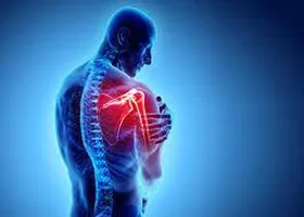 شانه یخ&zwnj;زده چیست؟