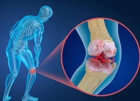 زنان برای پیشگیری از پوکی استخوان، روزانه چقدر کلسیم مصرف کنند؟