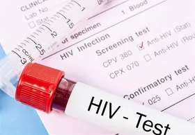 انجام ۳۲ هزار تست HIV در جمعیت&zwnj;های در معرض خطر و زندان&zwnj;های زیر پوشش دانشگاه علوم پزشکی مشهد