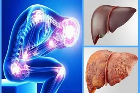 پیشگیری و راهکار&zwnj;های درمان و تشخیص کبد چرب