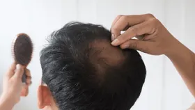 برای جلوگیری از ریزش مو این خوراکی&zwnj;ها را بخورید