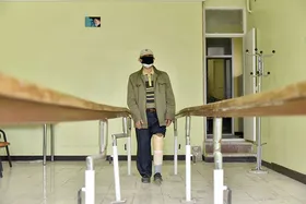 معلولیت&zwnj;های ثانویه جانبازان را فراموش نکنیم
