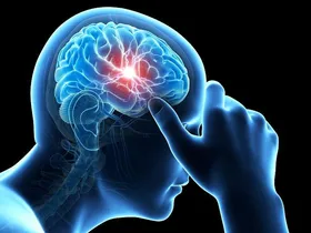 افزایش سردردهای مستمر در زنان با مصرف بیش از حد دارو