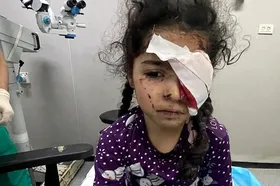تاکنون ۱۵۰۰ فلسطینی در جنگ غزه بینایی خود را از دست داده&zwnj;اند