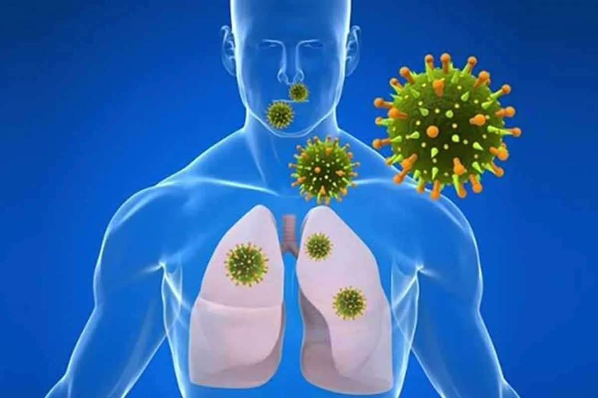عفونت ویروسی دستگاه تنفسی چه علائمی دارد؟