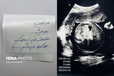 «جانِ مادر»