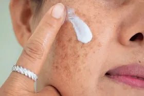 با منافذ باز پوست چه کنیم؟ | این منافذ به طور قطعی درمان می&zwnj;شوند؟