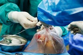 بیمار مرگ مغزی در مشهد جان سه نفر را نجات داد