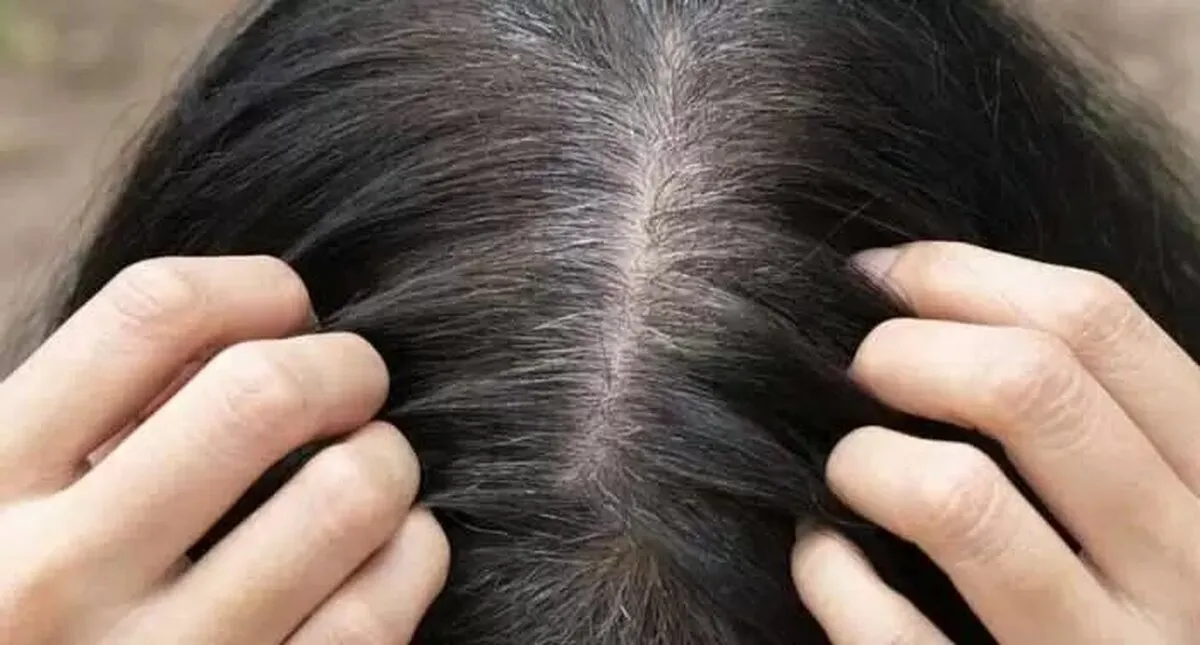 آیا مو‌های سفید دوباره سیاه می‌شوند؟