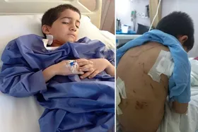 ۸ سگ وحشی به پسر بچه نیشابوری حمله کردند | حال پسربچه مساعد نیست