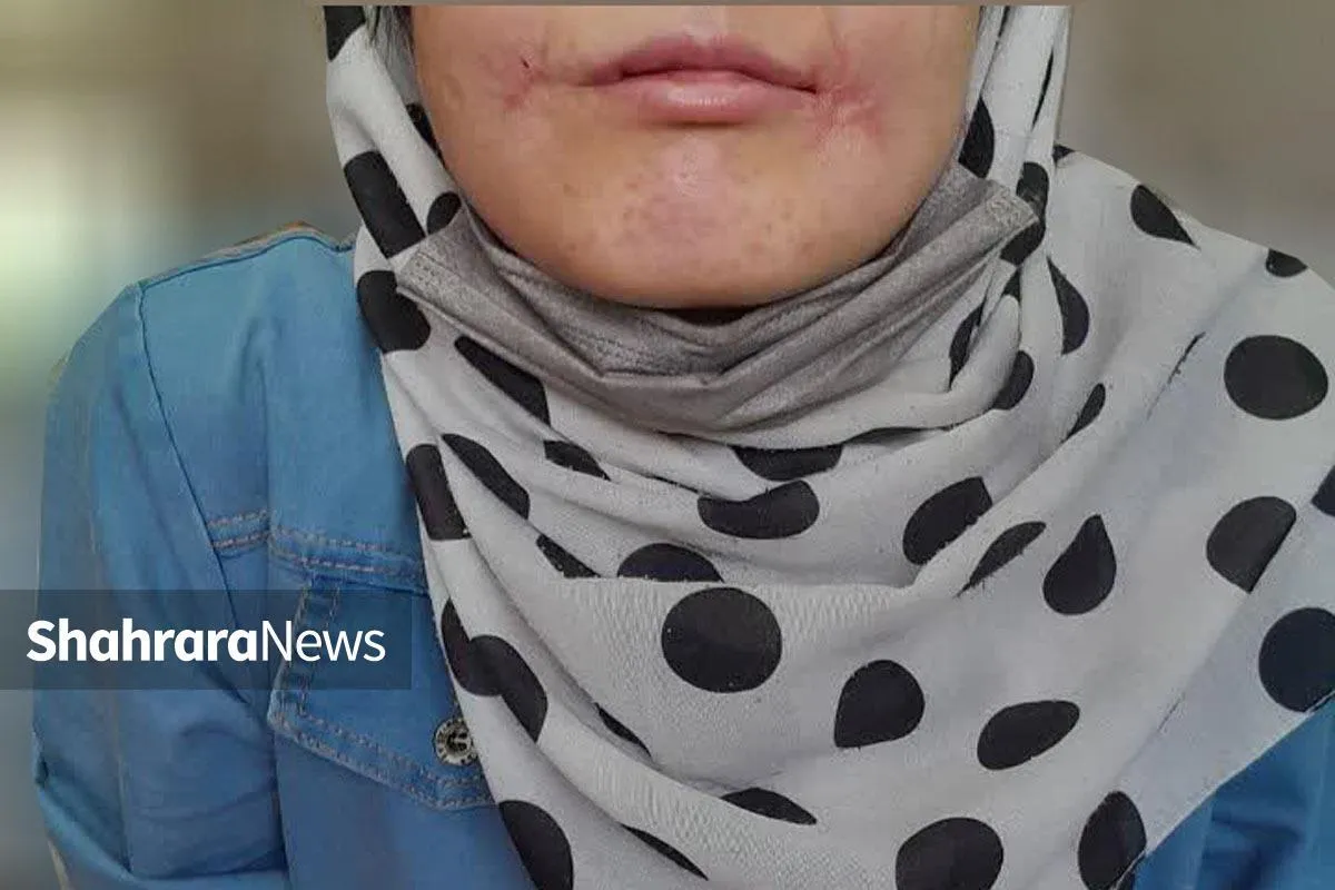 مرد معتاد لب‌های زن ۱۸ ساله‌اش را دوخت| اظهارات تکان‌دهنده فائزه در کلانتری خواجه‌ربیع مشهد