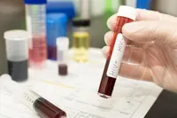شناسایی ۴۱ هزار مبتلا به HIV در کشور تا کنون (۲۴ آبان ۱۴۰۴)