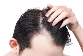مراقب مو&zwnj;های مشکی خود باشید