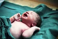 ۱۶ میلیون زن متاهل داریم، اما یک میلیون زایمان انجام می‌شود | سبزوار و تربت‌جام خراسان رضوی رکورددار کمترین میزان سزارین در کشور